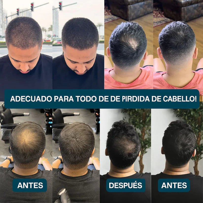 SHAKE - Camuflaje capilar profesional