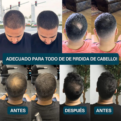 SHAKE - Camuflaje capilar profesional